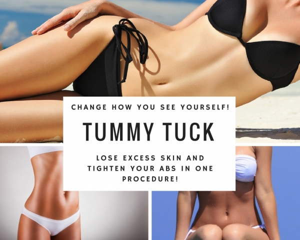 Tummy Tuck | Boca Raton Plastic Surgery