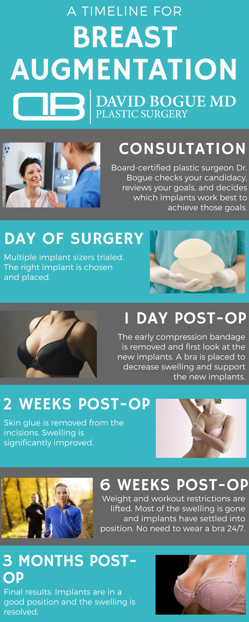 Breast Augmentation Timeline BogueDavid