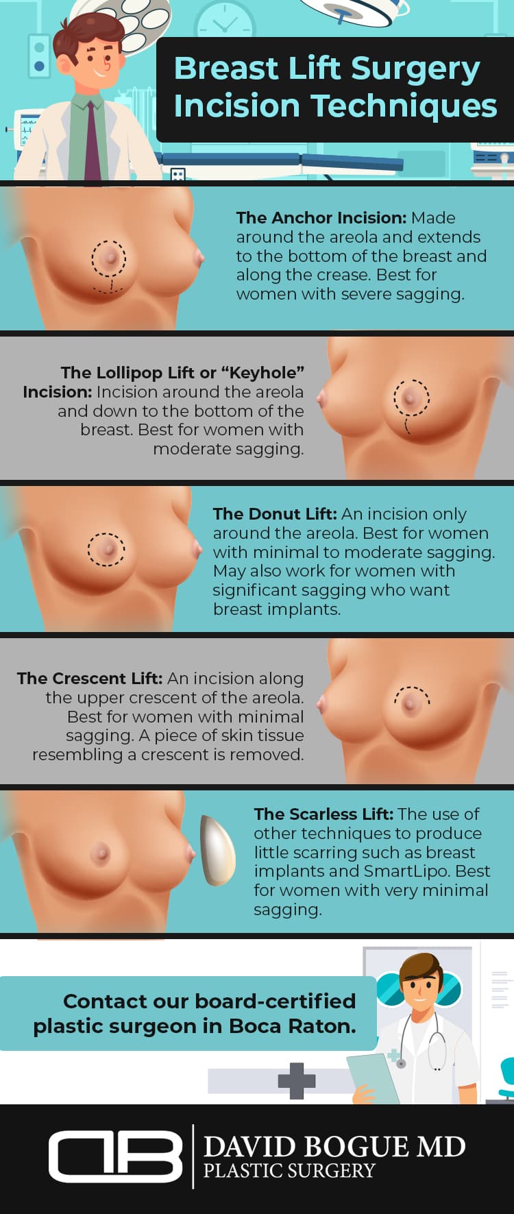 bogue Breast lift surgery incision techniques rev 2 (1)