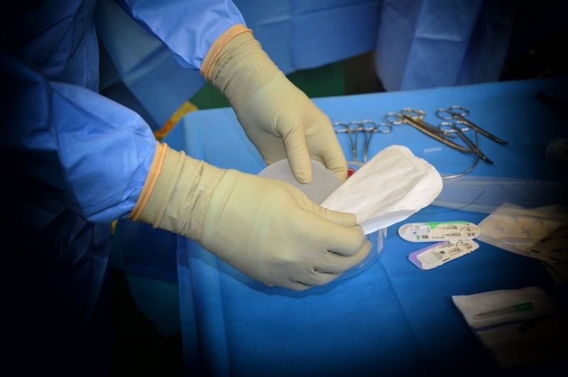 breast implant removal (1)