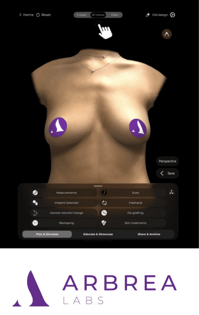 Arbrea 3D breast augmentation simulation used for implant planning in Dr. Bogue's Boca Raton office